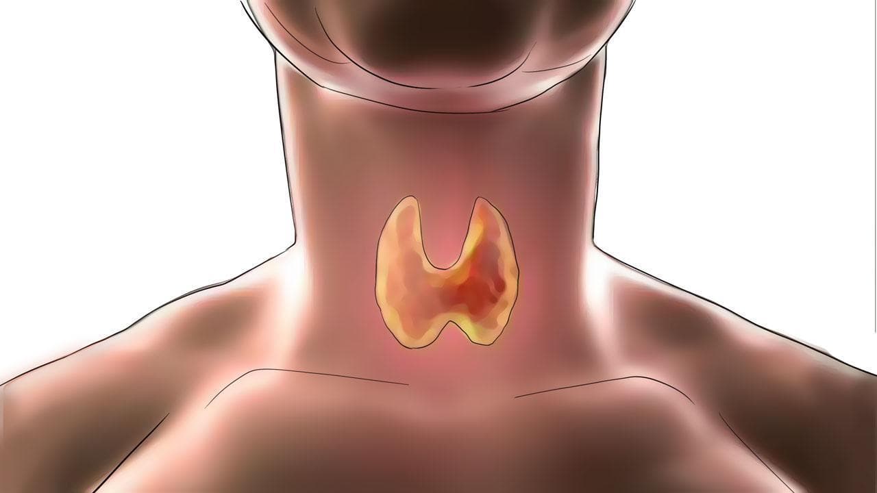 血清总三碘甲状腺原氨酸