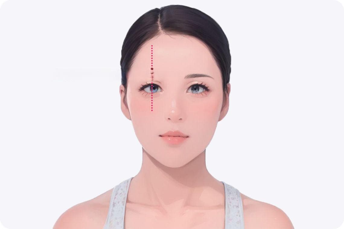 消除眼袋的按摩方法