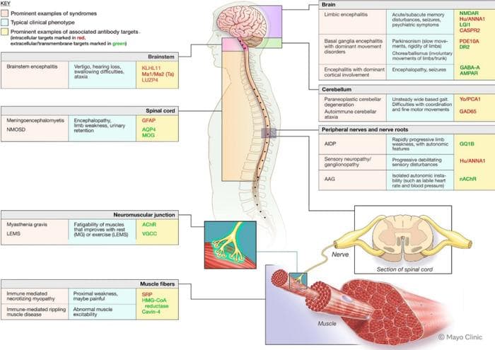 Neuron最新综述：神经系统自身免疫性疾病——生物标志物、免疫机制和治疗靶点