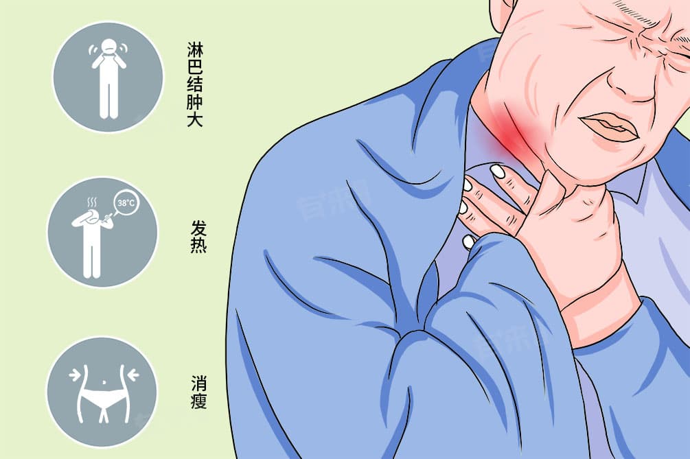 淋巴癌传染吗