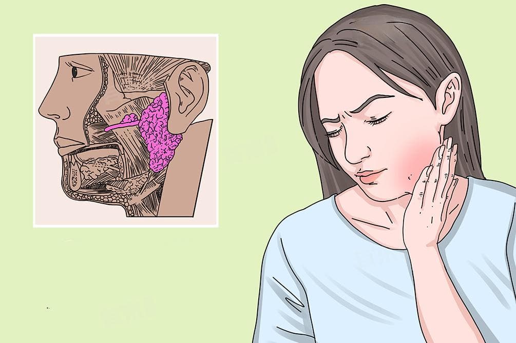 什么是腮腺肿瘤？病因、症状、检查与治疗全解析