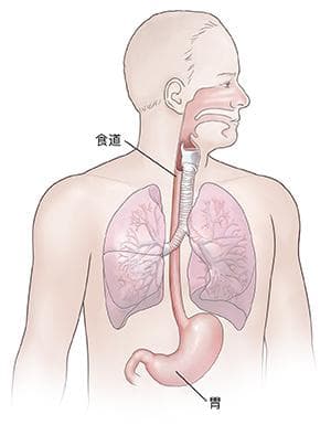 胃食管反流病（GERD）：症状、护理与治疗指南