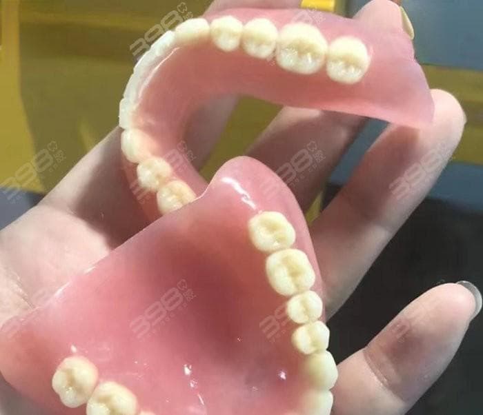 常见的活动义齿的种类和材料有哪些？康康全口义齿选哪个价格不贵