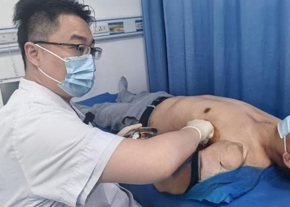 男子健身一年胸肌“爆涨”  竟因“练”出了一个巨大脂肪瘤