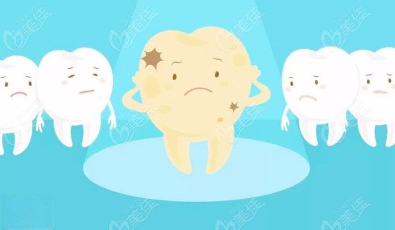 牙齿上出现小黑点要重视起来，这里教你如何预防小黑点