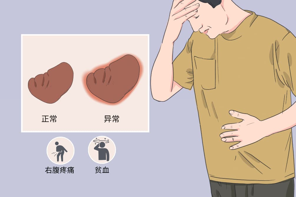 脾大的原因和危害