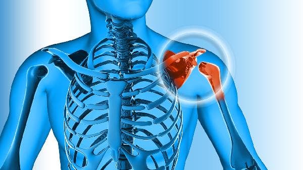 多发性骨髓瘤的病因、风险因素及预防措施