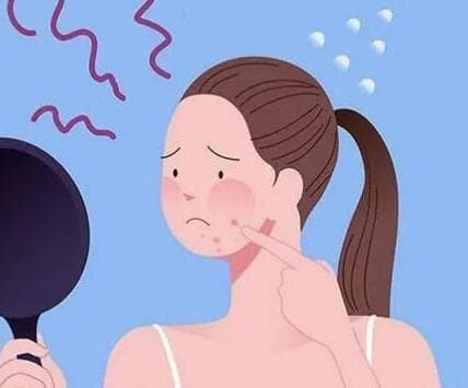 激光治疗痤疮：安全有效，中重度患者的新选择