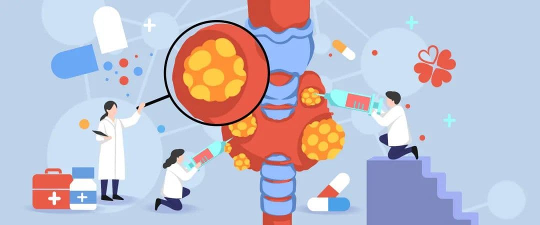 甲状腺结节细针穿刺活检，做还是不做？