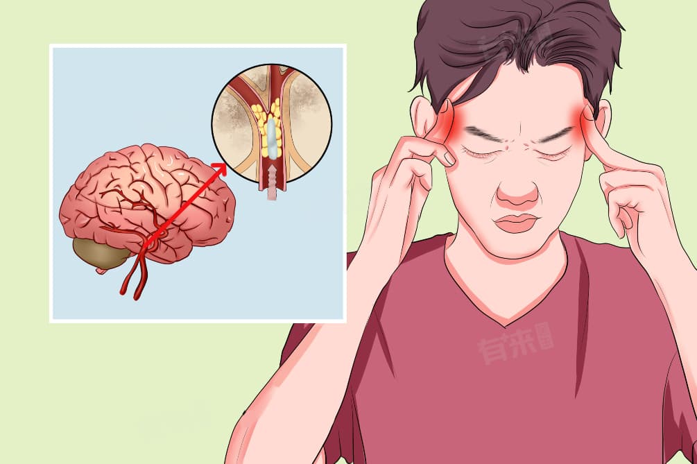 脑梗病人睡不着觉的解决方法