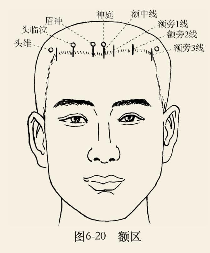 头皮针法简介