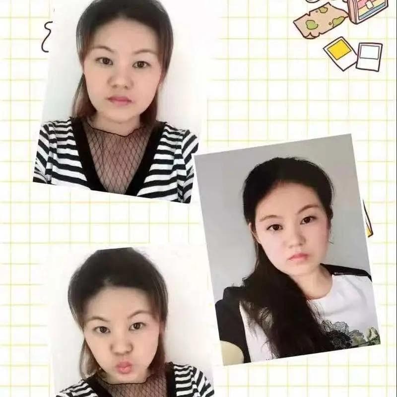 水霉病的发生与防治