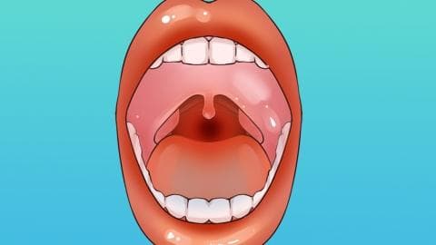 喉咙痒最快的缓解方法有哪些
