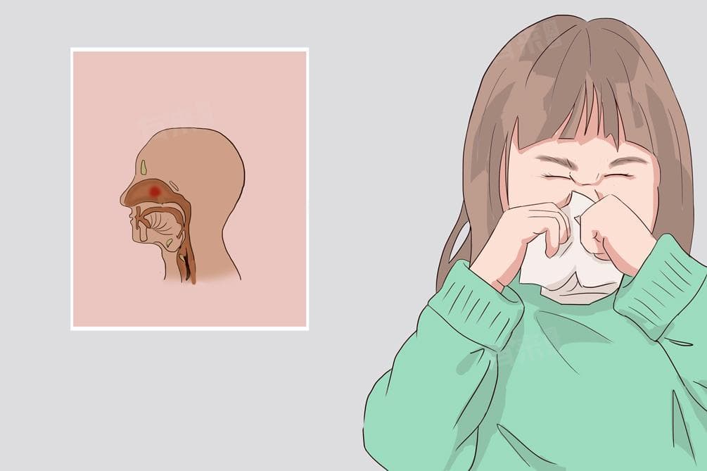感冒怎么好得快