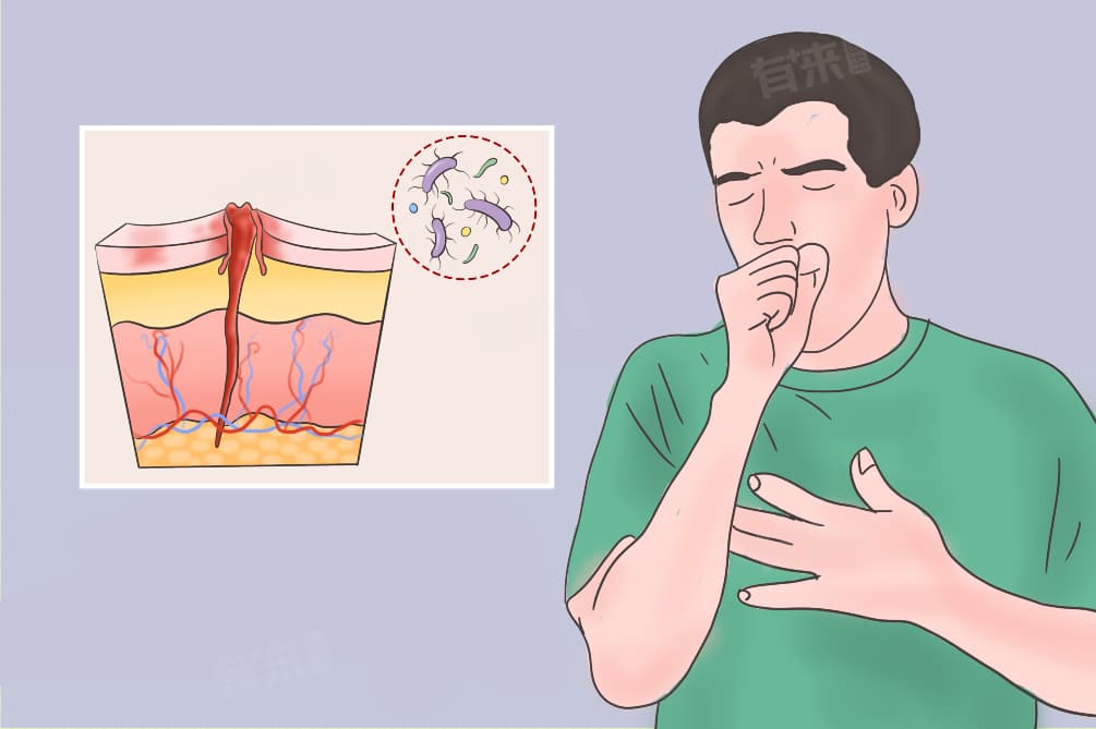 SIRS医学上是什么意思