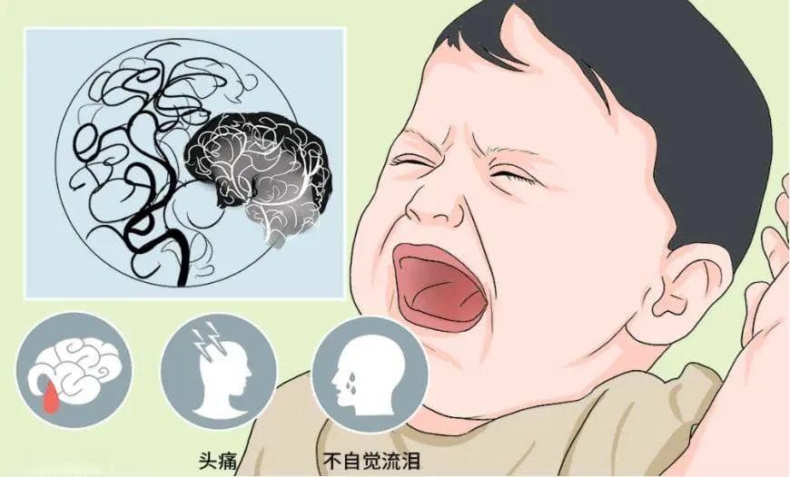 健康科普丨孩子手脚无力、发麻，警惕儿童烟雾病