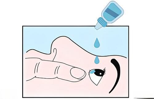 滥用激素眼药水危害大，这些护眼误区要当心
