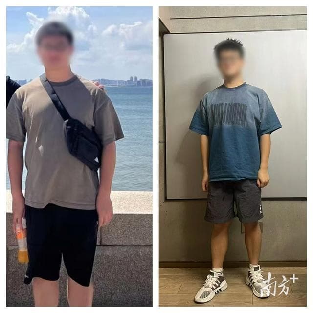 大学生一个月瘦20斤，脂肪肝却变为重度，如何正确改善脂肪肝？