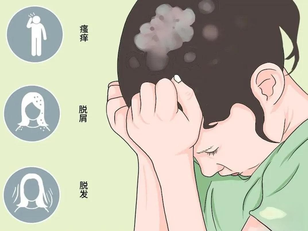 头癣：症状识别与治疗方法全解析