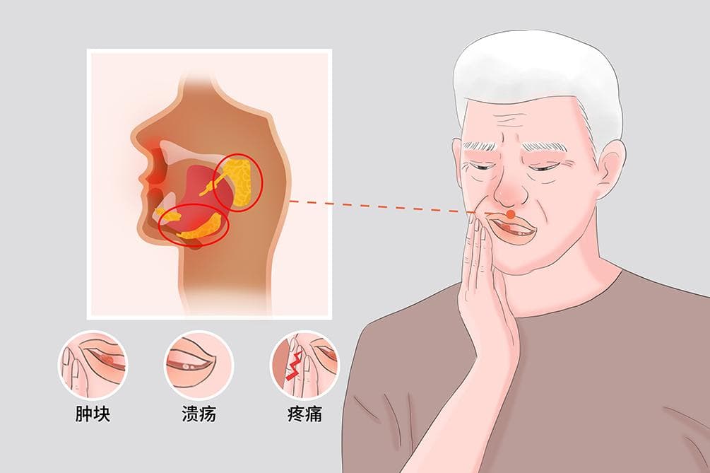 口腔颌面部肿瘤