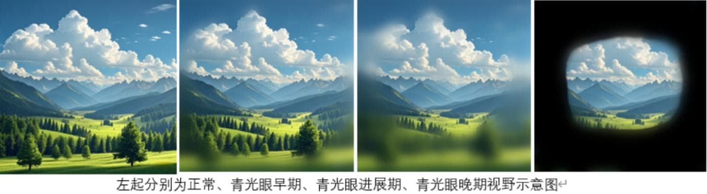 预防青光眼，守护视力健康