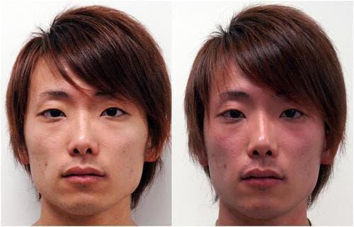 科学发现，喝酒脸红的伤害被远远低估了！