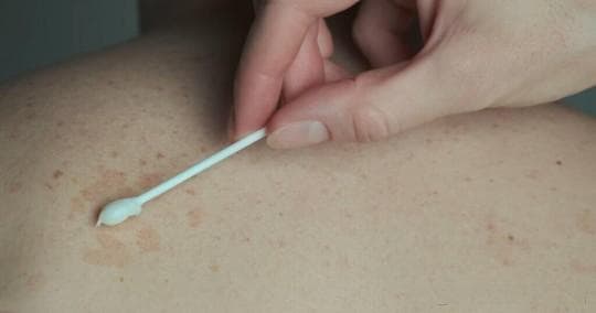 多磺酸粘多糖乳膏可以长期涂脸上吗？使用注意事项全解析
