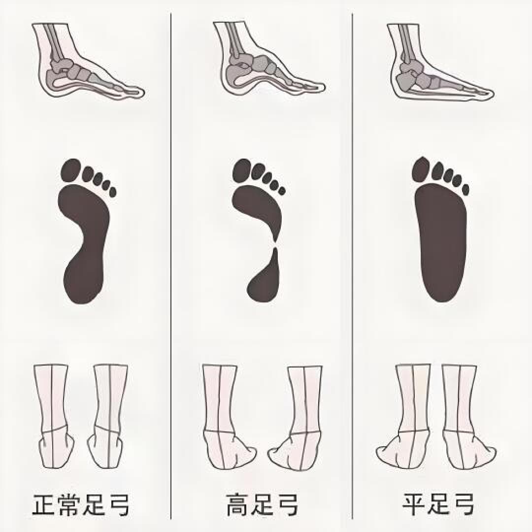专业跑鞋怎么选？四步避坑法让你告别膝盖疼和足底筋膜炎