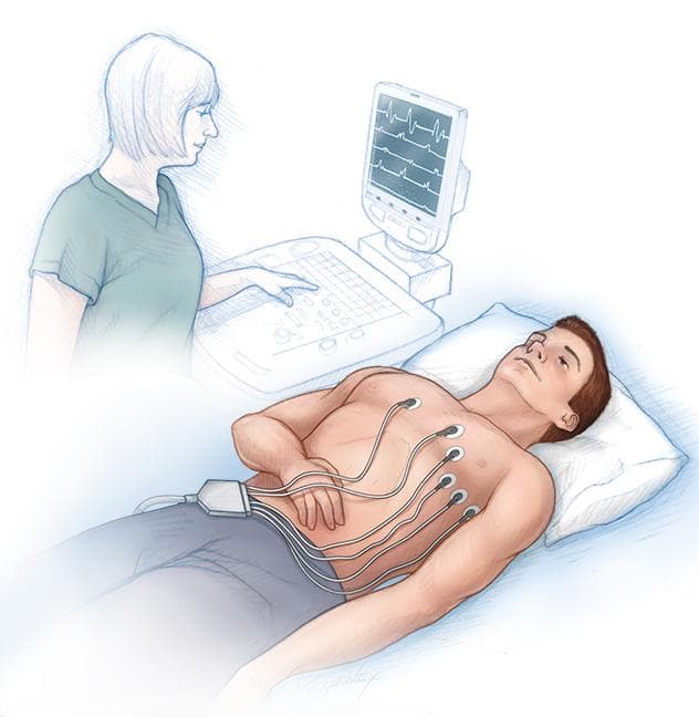 心电图（ECG或EKG）检查详解：原理、目的、风险及结果解读