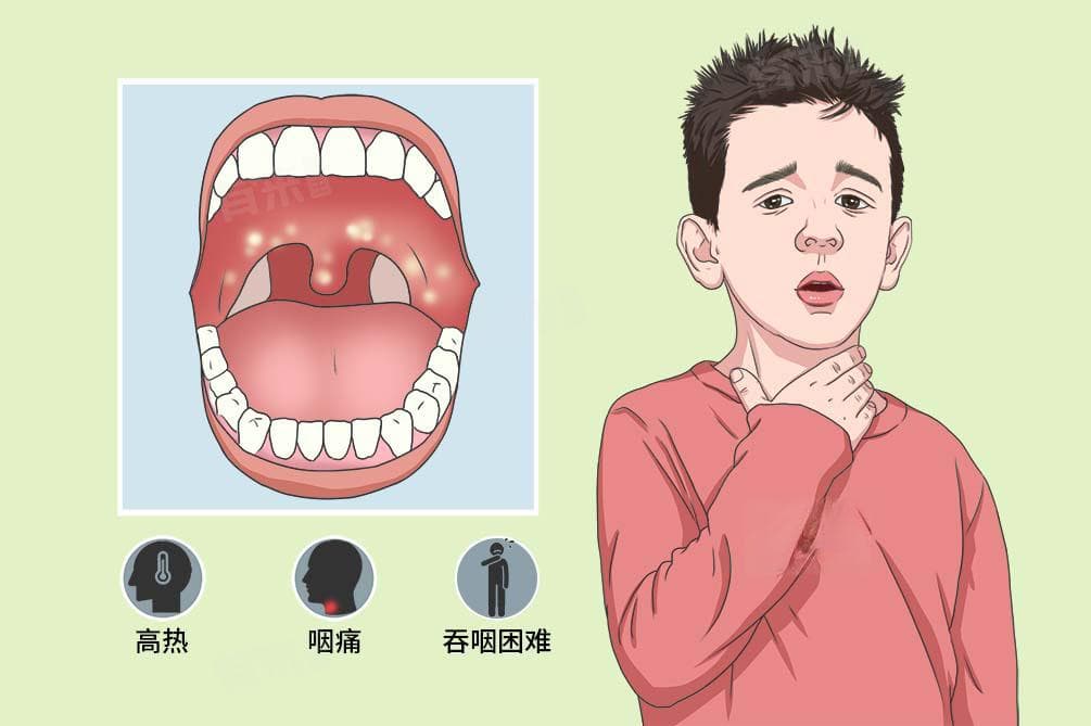 口腔炎是什么原因引起的