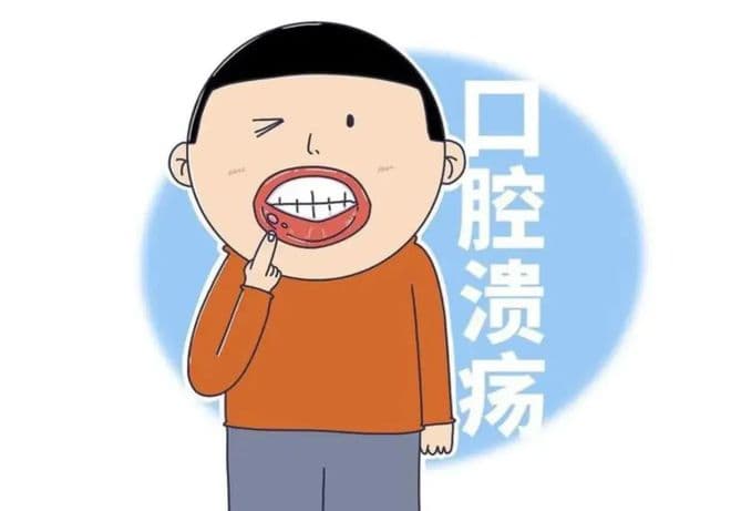 经常口腔溃疡的人可能缺乏哪些营养素？
