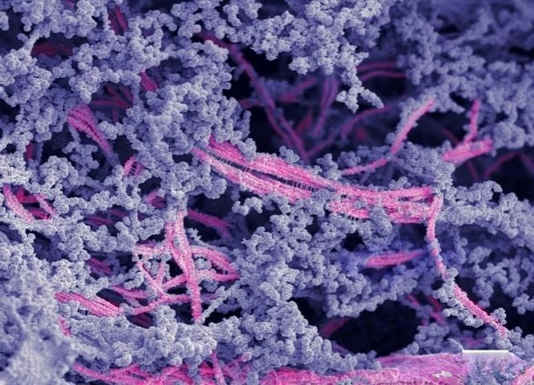 美国西北大学团队研发出能再生膝关节高质量软骨的生物活性材料