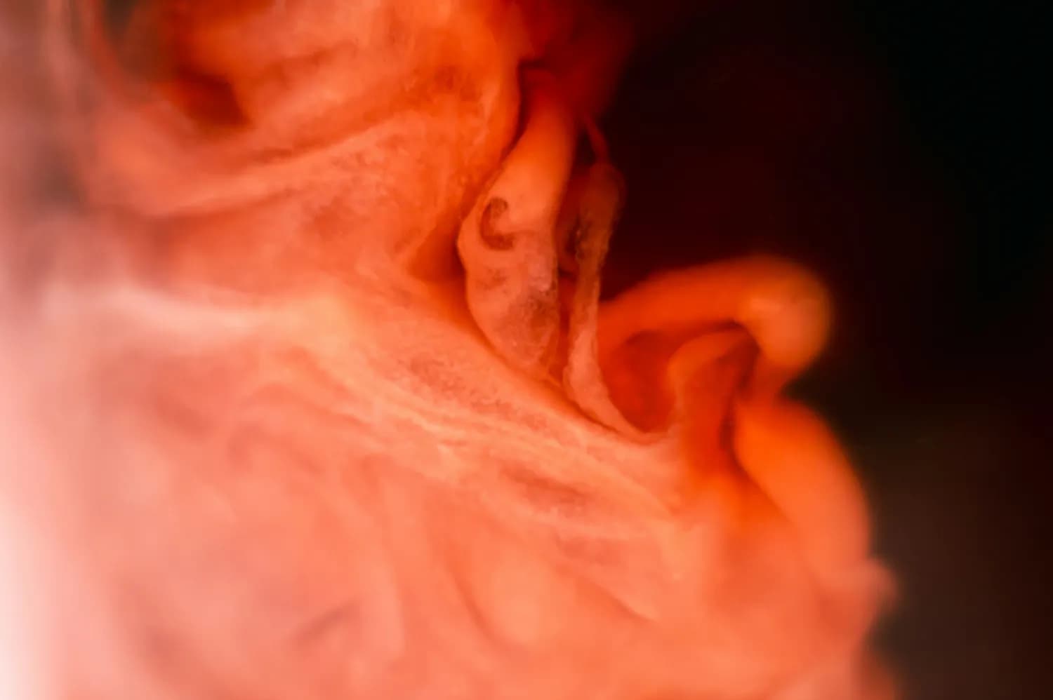 胃部健康大揭秘：如何预防胆汁反流？