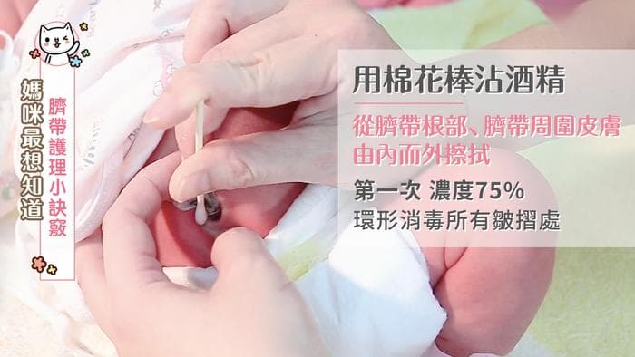 新生儿脐带护理全攻略：护理长传授四步清洁法