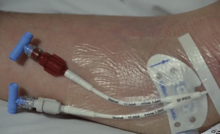 留置针、CVC、PICC、输液港有什么区别？5 种静脉通路大对比