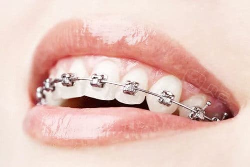 人的门牙有什么讲究吗?门牙的大小|整齐度|缝隙大等都可通过美学修复牙齿来改善