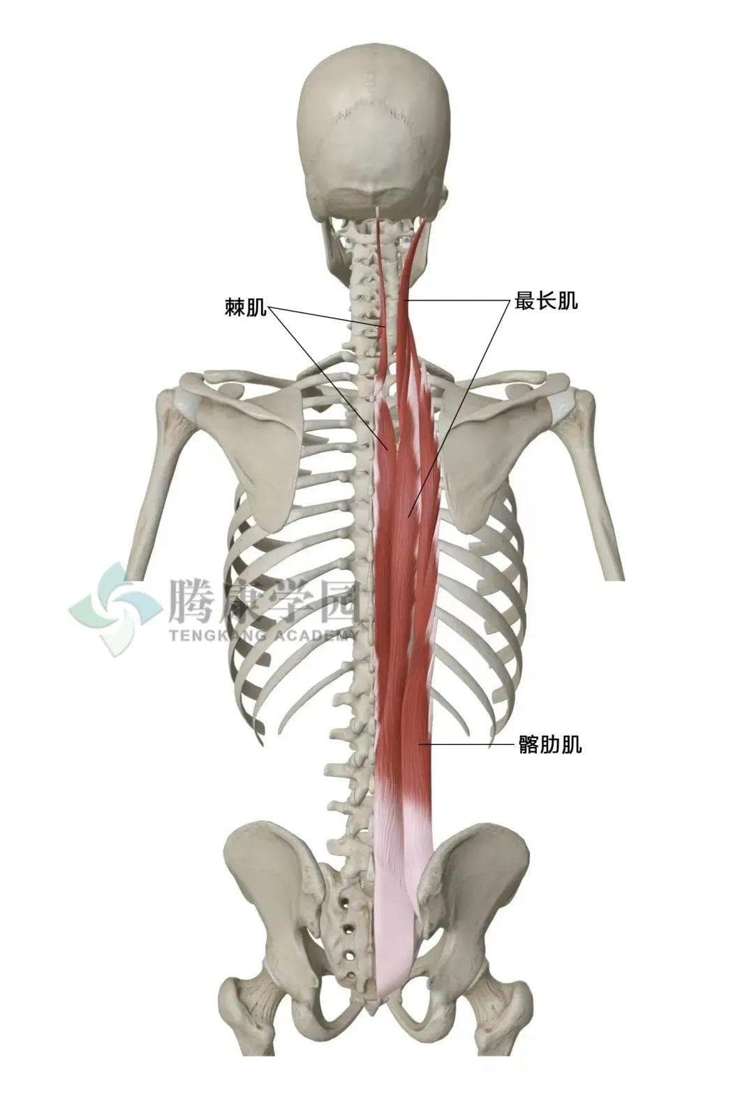 急性腰扭伤的分型：软组织型、神经型和关节型