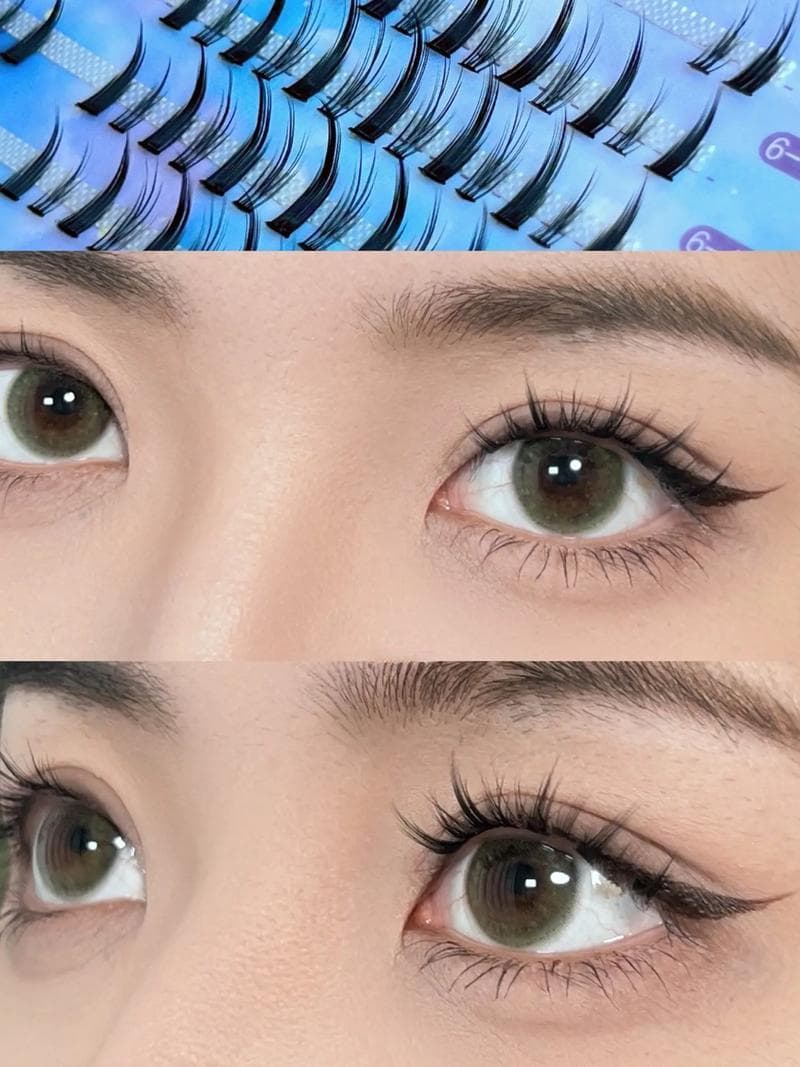 双眼皮手术的优缺点及适用情况分析：怎么样选择较合适的手术方式？