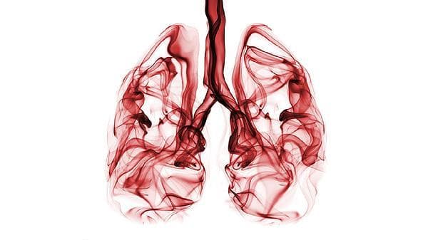 肺结节检查：DR还是CT？两种检查方法的优劣对比