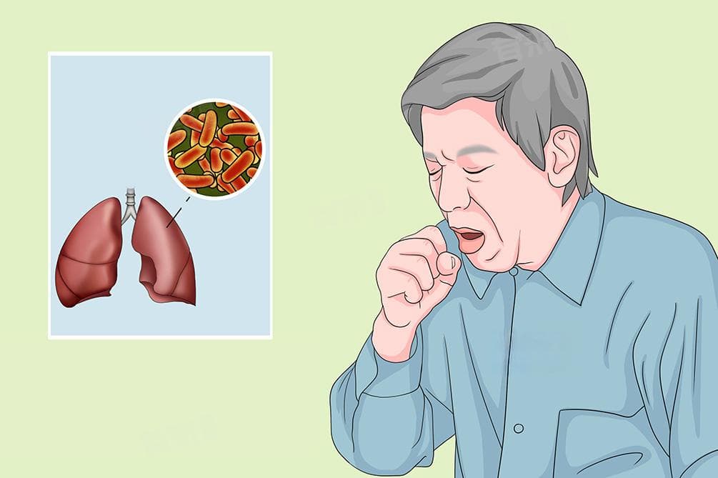 肺结核算是重大疾病吗