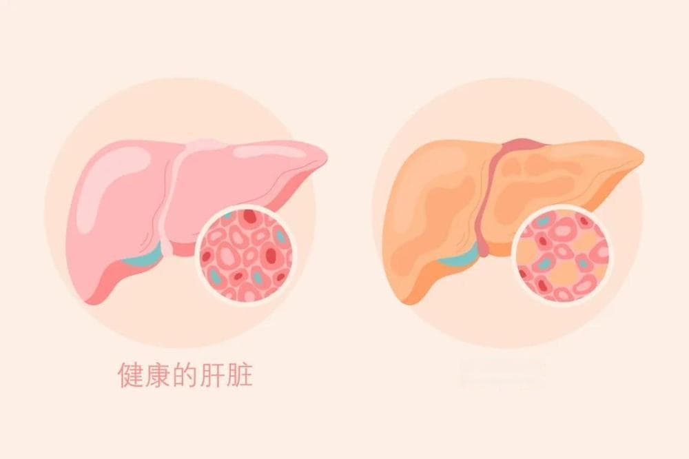拒绝盲目减肥！中老年人群科学减重记住四个要点