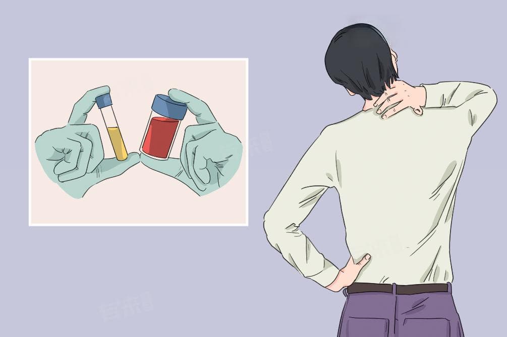 嘌呤是什么