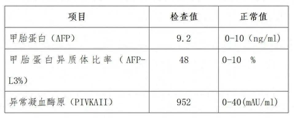 肝功能没这 3 种提示，就可以安心了