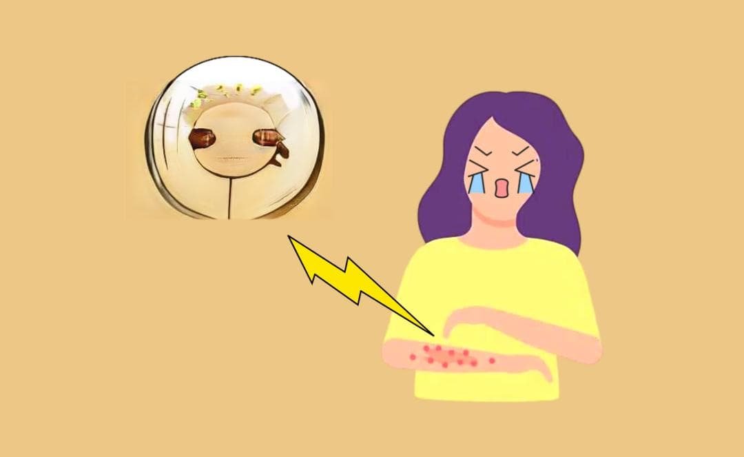 瘙痒难忍、反复发作！这个皮肤病是全球1亿多人的噩梦……
