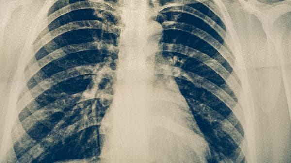 青少年能吃肾宝片吗？专家解析其潜在风险与科学调理方法