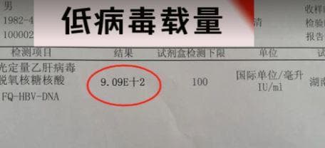 乙肝病毒定量达何程度算高？一次性讲清楚！