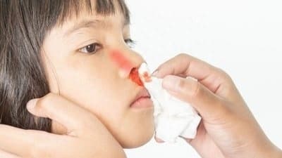 孩子流鼻血怎么办？这些情况需警惕，及时就医！