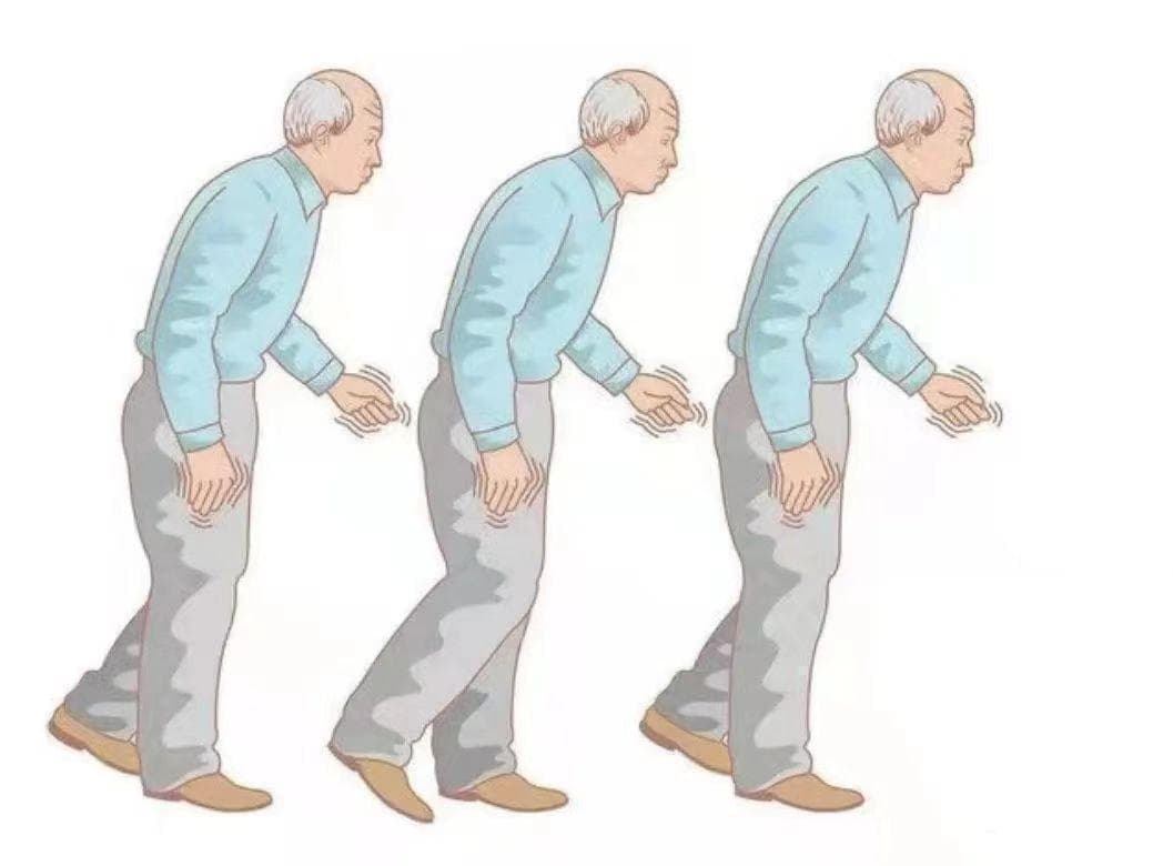 体位性低血压与心理健康：你了解多少？