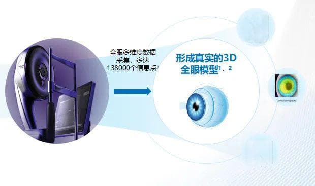 全光塑到底是个什么技术？能“个性化全眼定制”？