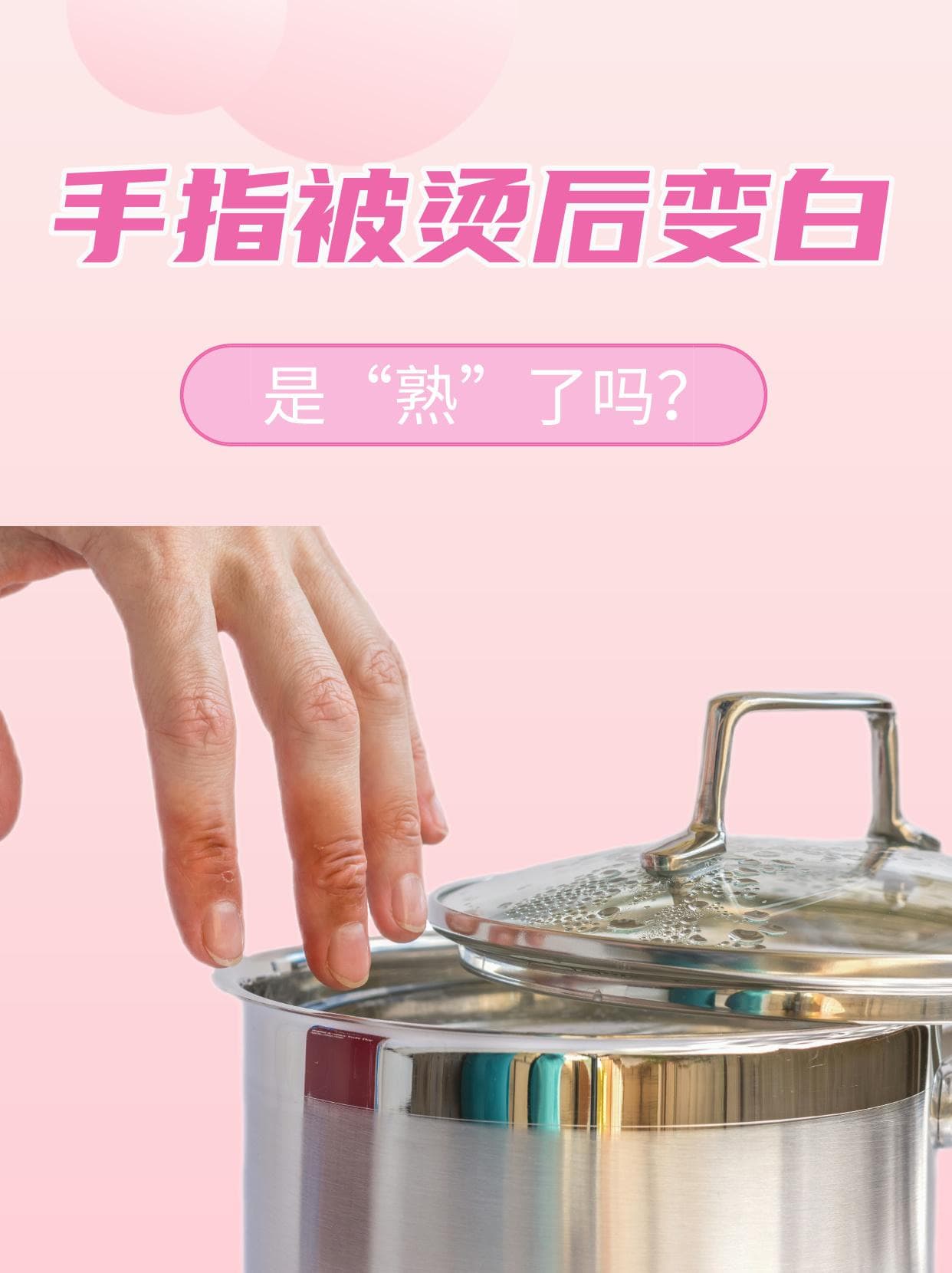 手指被烫后变白，是“熟”了吗？